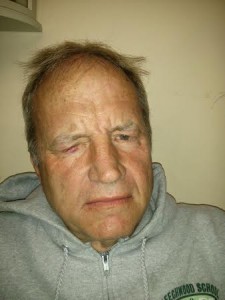 Chris Norby attacked by Martha